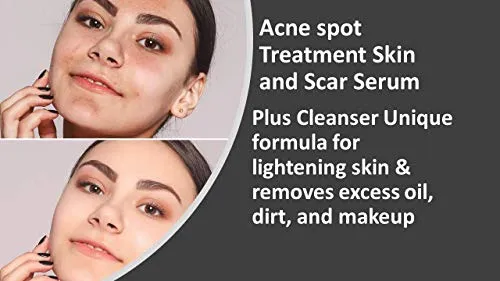 Acne spot Treatment Skin Serum Vitamin C, E and niacin amide Vitamin B3, B5, Acscanex for scars remove 50ML plus Face Cleanser 120Ml FREE