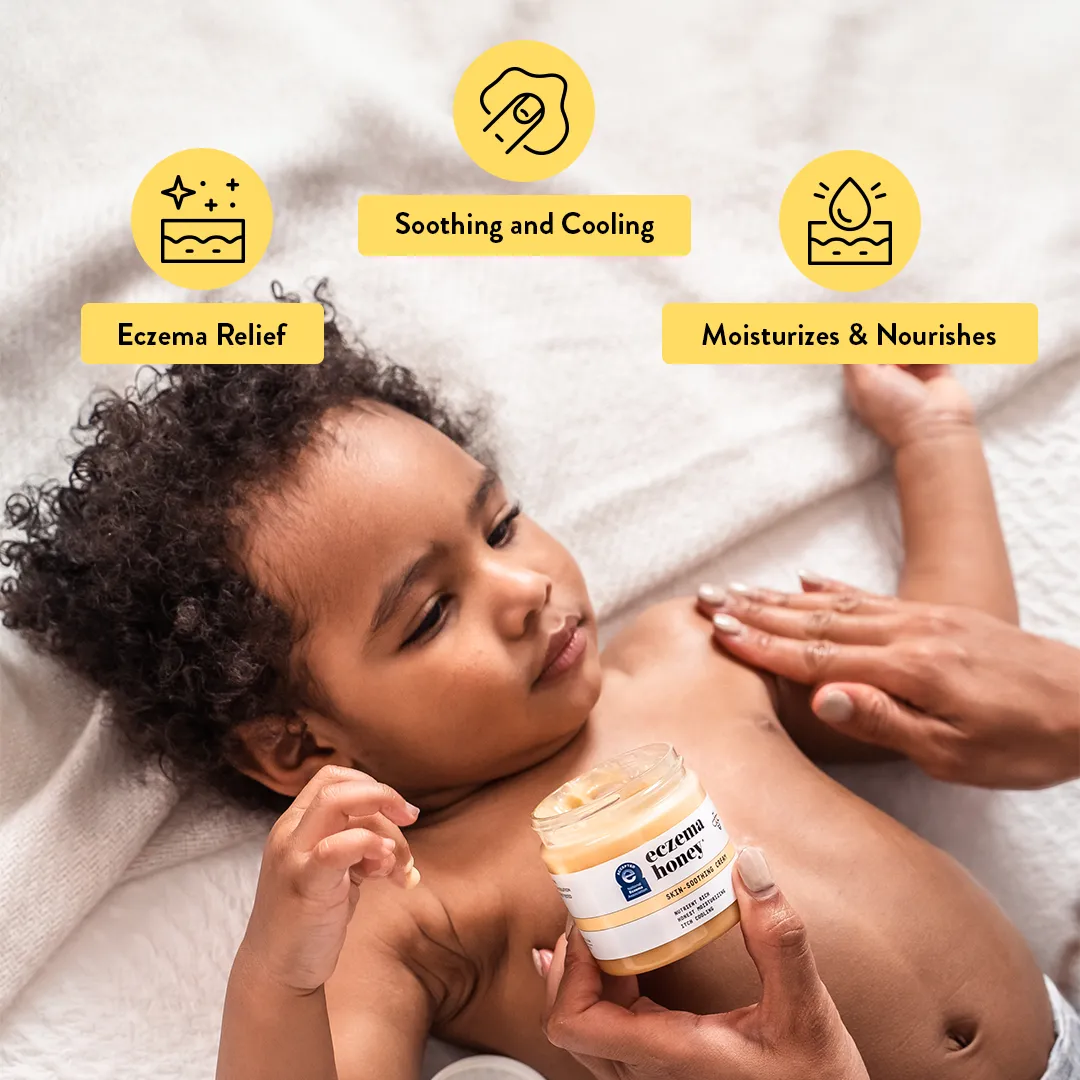 Eczema Honey Survival Kit